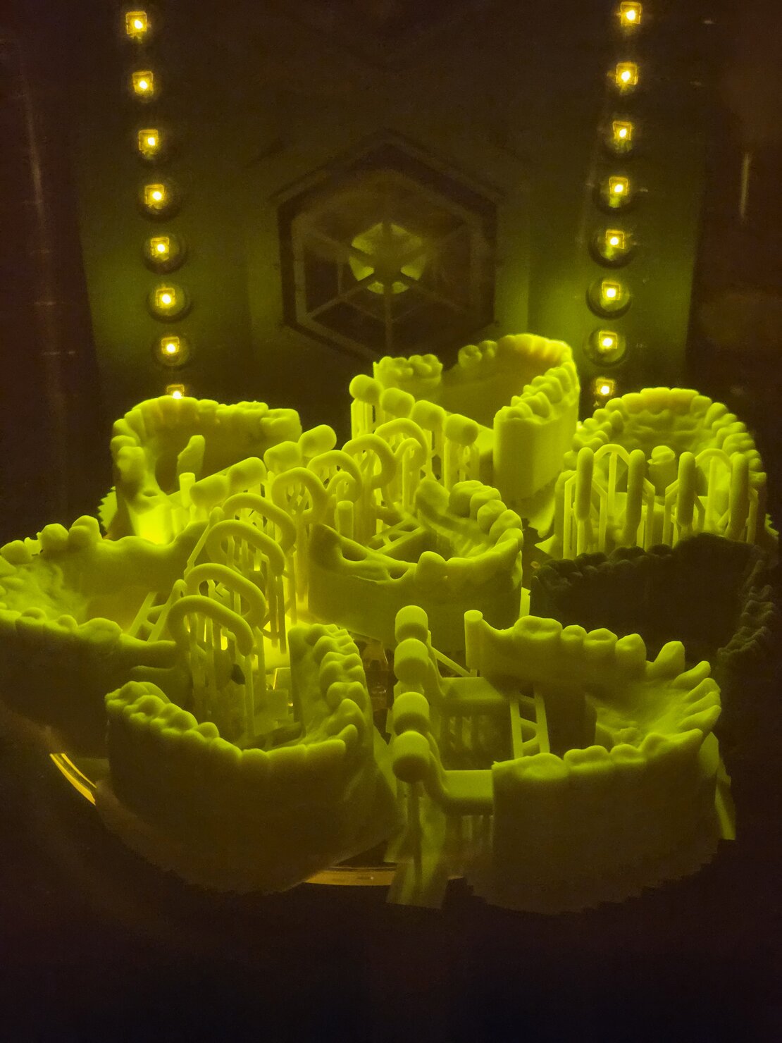 3D-Drucker im Dentallabor